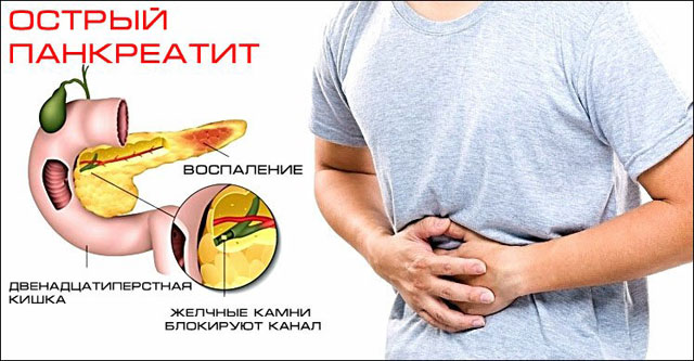 Щадящая диета для поджелудочной. питание при камнях в поджелудочной железе. пища для поджелудочной - меню на среду