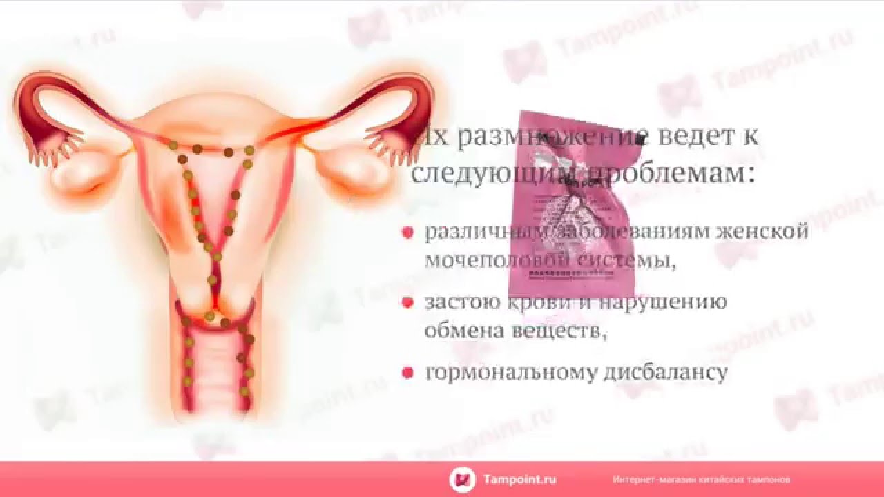 Свечи флексен в гинекологии отзывы