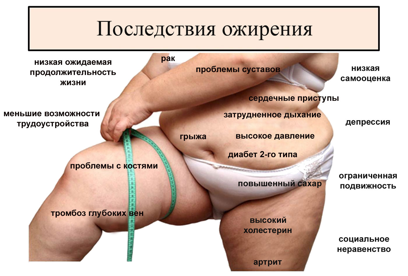 Весомая проблема: найдена связь между коронавирусом и ожирением