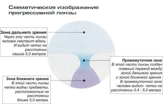 Что такое прогрессивные линзы для очков