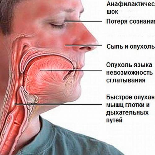 Признаки аллергии на яблоки