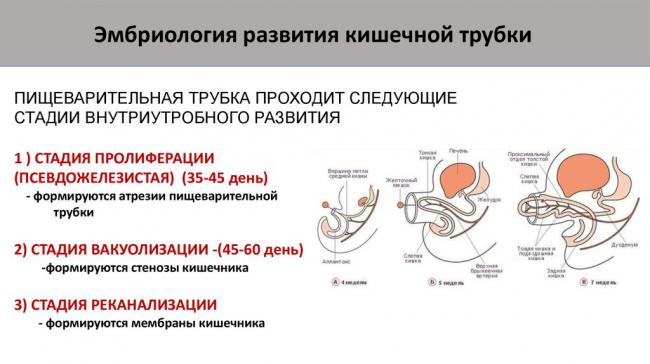 Операции при непроходимости кишечника: проведение, последствия