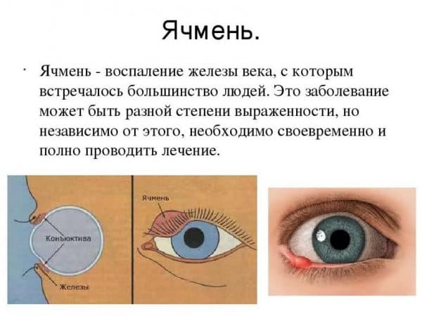 Воспаление века глаза народные средства