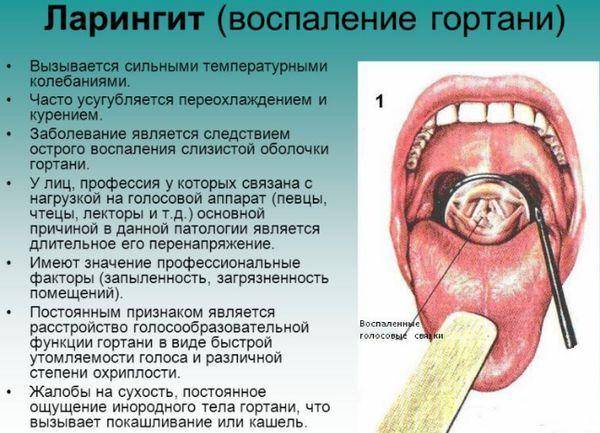 Лечение ларинготрахеита у взрослых препараты