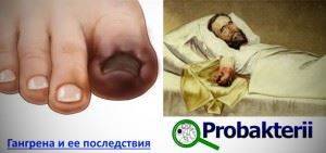 Бактериальные токсины их классификация и основные свойства