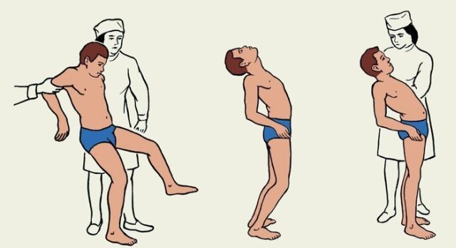 Наследственная атаксия фридрейха: симптомы, методы диагностики и лечение