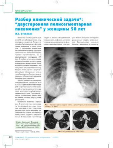 Понятие метатуберкулезных изменений