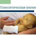 Почему увеличена печень у ребенка?
